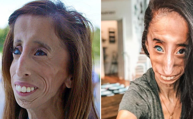 Chuyện người phụ nữ bị gọi là “xấu nhất thế giới”, từng là nạn nhân bạo lực  mạng toàn cầu và cuộc sống đáng ngưỡng mộ hiện tại