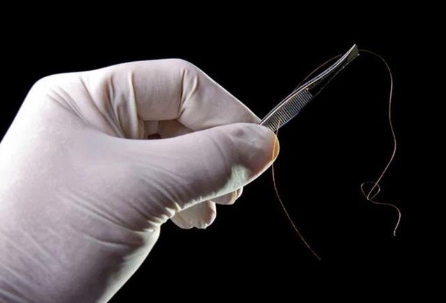 Chàng trai Việt kiều cầm 2 sợi tóc đi xét nghiệm ADN: Đọc kết quả xong chỉ biết buồn- Ảnh 1.