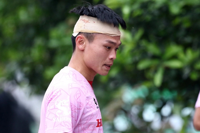 Công Phượng chưa được tập luyện cùng Văn Toàn; tuyển thủ U23 Việt Nam chảy máu đầu trong buổi tập- Ảnh 3.