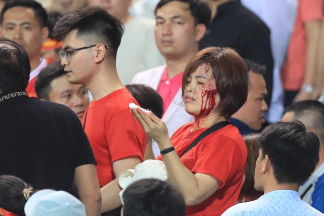 CĐV Việt Nam bị đánh chảy máu đầu ngay tại sân Mỹ Đình trong ngày đội nhà thua Indonesia- Ảnh 3.