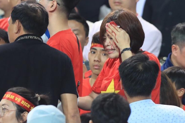 CĐV Việt Nam bị đánh chảy máu đầu ngay tại sân Mỹ Đình trong ngày đội nhà thua Indonesia- Ảnh 1.