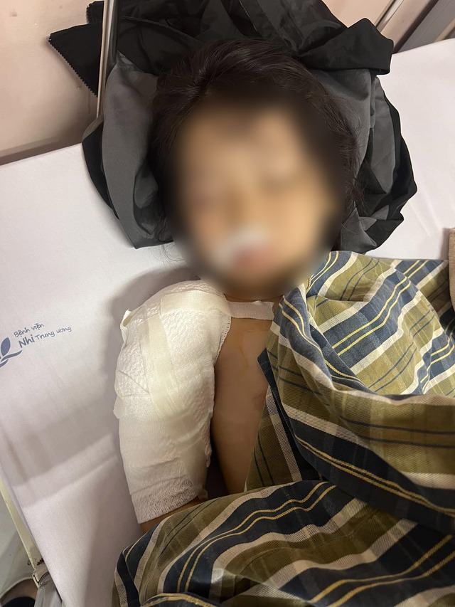 Vụ bé gái 5 tuổi ở Hà Giang bị chó cắn nhập viện: Con chó có nhiều 