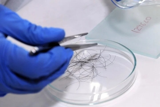 Cô gái mang tóc của 4 người đàn ông đi xét nghiệm ADN, kết quả khiến tất cả bất ngờ- Ảnh 1.