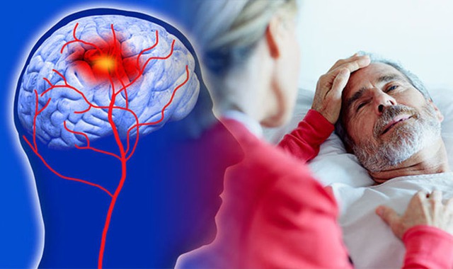 Người đàn ông 53 tuổi liệt nửa người, đột quỵ não giữa đêm: BS chỉ ra ngay 2 thói quen làm tăng nguy cơ- Ảnh 1.