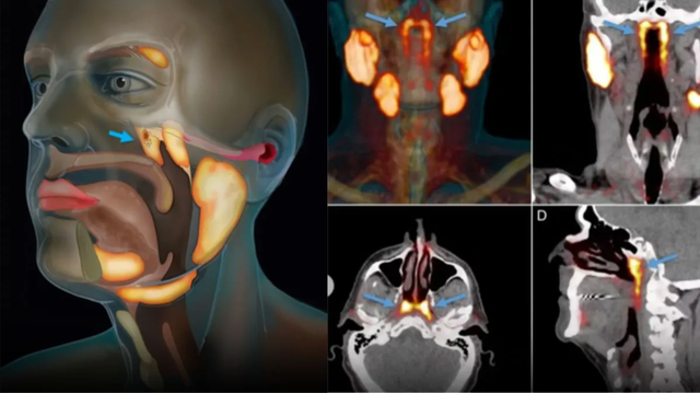 Phát hiện cơ quan mới “ẩn mình” suốt hàng thế kỷ trong thân người, giới khoa học sững sờ vì lý do khó tin- Ảnh 3.