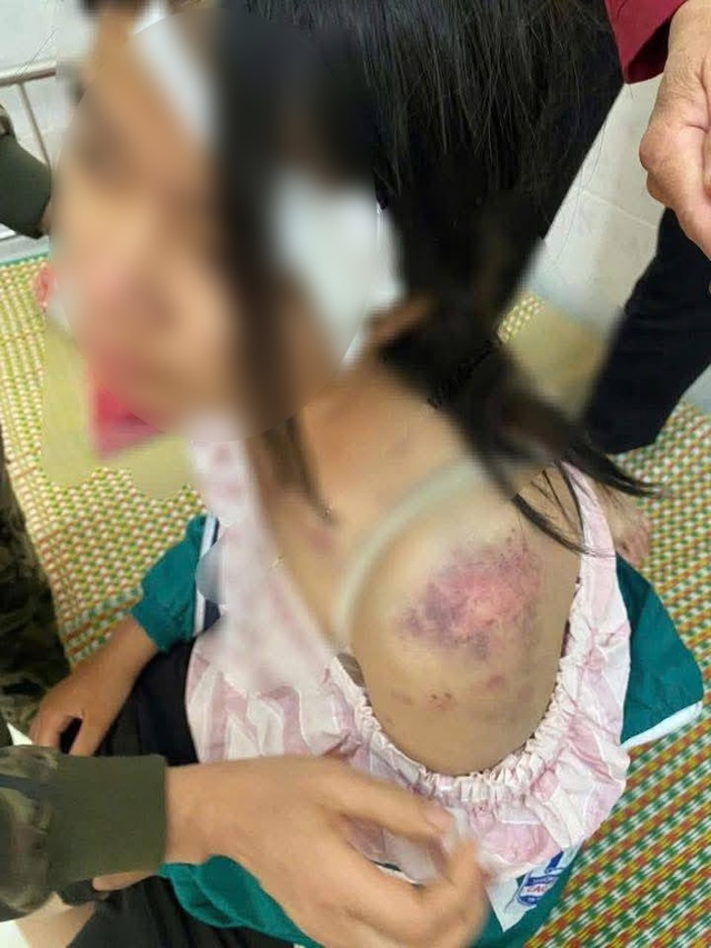 Hoàn cảnh cháu bé bị bà nội và 2 người đàn ông bạo hành: Bố mẹ ly hôn khi mới 1 tuổi, kể bị đánh 4 tiếng- Ảnh 1. Hoàn cảnh cháu bé bị bà nội và 2 người đàn ông bạo hành: Bố mẹ ly hôn khi mới 1 tuổi, kể bị đánh 4 tiếng- Ảnh 1.