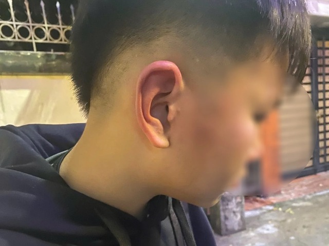 Hà Nội: Bé trai 12 tuổi nghi bị bố của bạn đánh phải đi viện, hé lộ nguồn cơn - Ảnh 1.