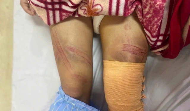 Vụ b&eacute; g&aacute;i lớp 7 bị bố đ&aacute;nh nhập viện ở Nghệ An: Nguồn cơn từ con lợn đất? - Ảnh 1.