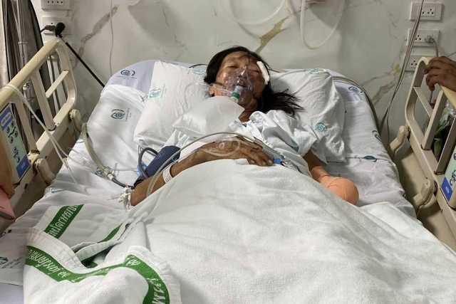 Đang đi đường, người phụ nữ gặp tai nạn mất đi 1 bàn tay, "thủ phạm" là thứ ngay trên người nạn nhân - Ảnh 2.