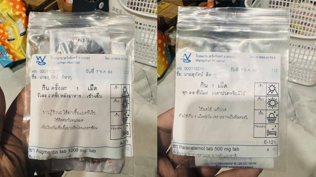 Nam thanh niên đến bệnh viện điều trị vết rắn cắn, sau khi trở về nhà thì chuyện lạ xảy ra - Ảnh 2.