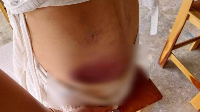 Bạn trai qua lại với 6 phụ nữ khác, cô gái hỏi đến liền bị đối phương tấn công, phải nhảy khỏi ban công - Ảnh 3.