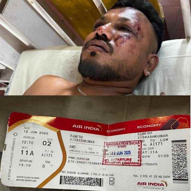 Hàng ghế 11, chỗ ngồi của hành khách sống sót duy nhất trên máy bay Ấn Độ rơi, đặc biệt như thế nào? - Ảnh 1.