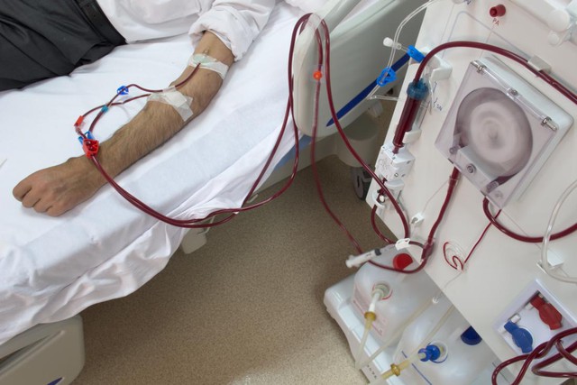 dialysis-machine-which-can-help-to-treat-acute-renal-failure-17518007941541246624772.jpg