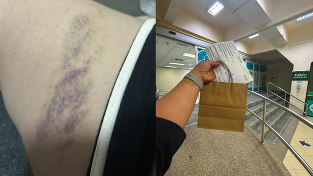 Đang ngồi bán hàng ở ven đường, cô gái nghe thấy tiếng động lớn, nhìn lên thì lập tức bỏ chạy - Ảnh 1.