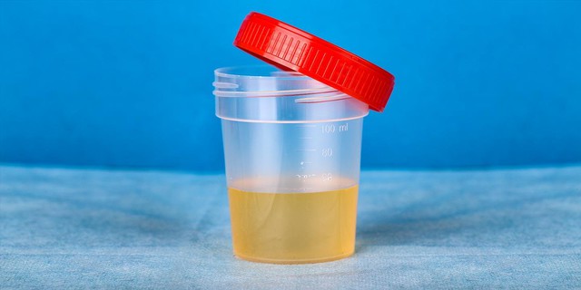  Người có thận khỏe thường có 4 điểm chung khi thức dậy vào buổi sáng: Ai có đủ thì xin chúc mừng!  - Ảnh 2.