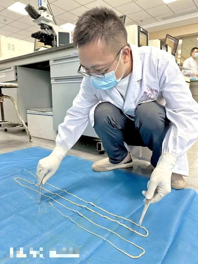 Sốc khi lấy ra sinh vật dài 4 mét từ cơ thể người đàn ông: "Thủ phạm" là 2 món nhiều người Việt mê - Ảnh 1.
