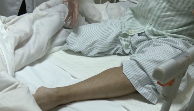 Người đàn ông bất ngờ phải cắt cụt bắp chân: Bác sĩ nói do chủ quan với 1 dấu hiệu bất thường- Ảnh 1.