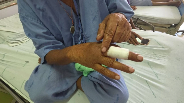 Nghĩ là tìm được 1 bụi nấm, người phụ nữ vừa đưa tay ra hái thì hét lớn, chứng kiến cảnh kinh hoàng - Ảnh 3.