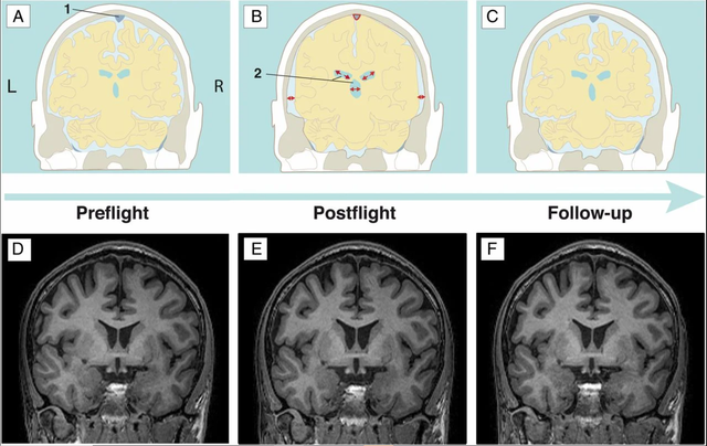 Não phi hành gia 'biến dạng' sau thời gian trên vũ trụ: Ảnh chụp hé lộ khác biệt này so với người thường - Ảnh 1.