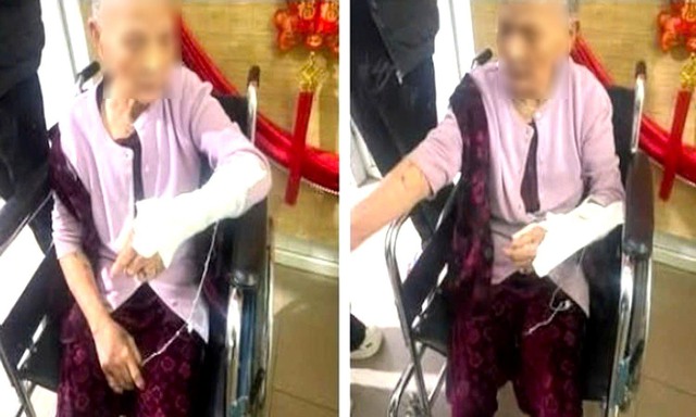 Diễn biến mới vụ con trai đ&aacute;nh mẹ gi&agrave; g&atilde;y tay m&ugrave;ng 3 Tết ở Nghệ An - Ảnh 2.