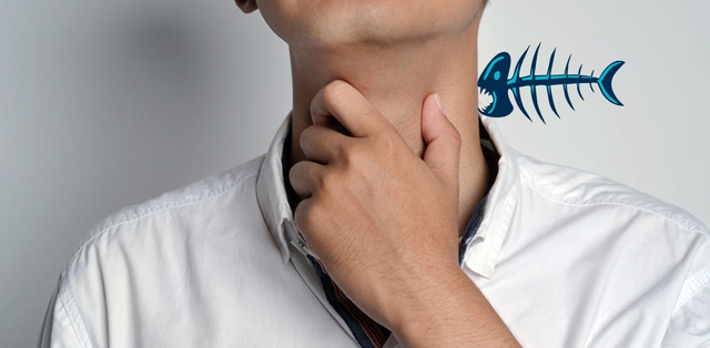 C&aacute;ch xử l&yacute; khi bị h&oacute;c xương c&aacute;: Đừng nuốt cơm, l&agrave;m 2 c&aacute;ch n&agrave;y hiệu quả, ai cũng l&agrave;m được - Ảnh 2.