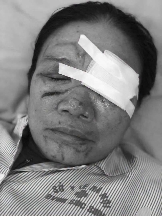 Chủ quán hải sản xịt nước khiến cụ bà bán rau chảy máu mắt: Mong giải quyết theo hướng tình cảm - Ảnh 3.