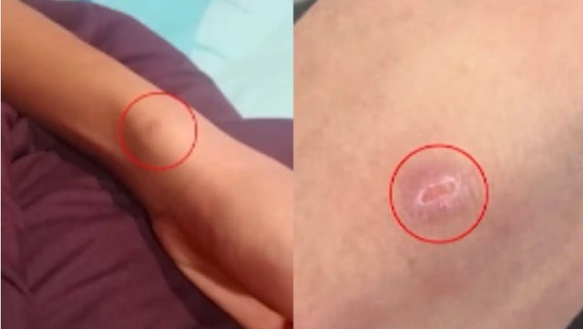 Bố mẹ đi làm xa, khi về nhà thì sốc với các vết thương trên cơ thể con trai, nghe lời kể càng bàng hoàng - Ảnh 1.