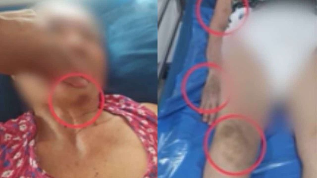Thấy mẹ có nhiều vết thâm tím, con trai xem camera thì đau đớn trước sự mất nhân tính của người chăm sóc - Ảnh 3.