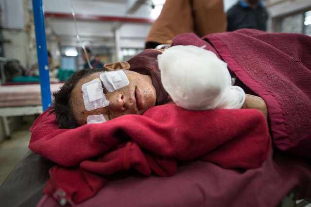 Một cậu bé nằm điều trị trong bệnh viện sau khi bị thương trong vụ đánh bom tự chế tại một điểm bầu cử ở Katmandu, Nepal.
