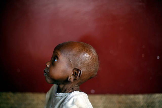 Waka, 2 tuổi, bị suy dinh dưỡng nặng, đang ngồi dưới sàn tại một trung tâm y tế trẻ em ở Bangui, CH Trung Phi.
