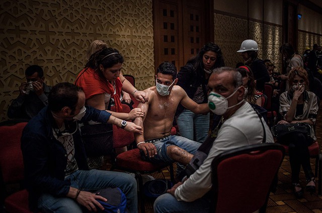 Một người được điều trị sau khi bị bắn đạn hơi cay trong cuộc biểu tình chống chính phủ ở Istanbul, Thổ Nhĩ Kỳ.