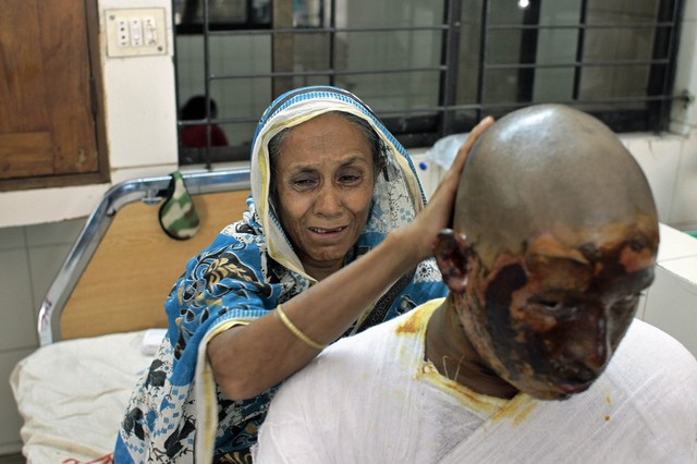 Người mẹ khóc khi chăm sóc đứa con bị thương trong một vụ đánh bom xe bus ở Dhaka, Bangladesh.