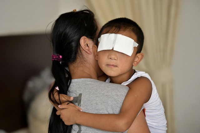 Cậu bé 6 tuổi bị móc mắt đang được bé bế trong bệnh viện ở thành phố Thái Nguyên, tỉnh Sơn Tây, Trung Quốc.