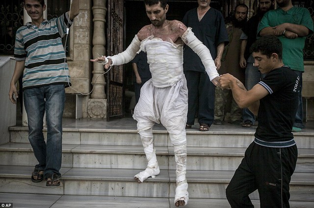 Một người đàn ông Syria rời bệnh viện dã chiến để về nhà sau khi bị bỏng nặng trong một cuộc không kích.
