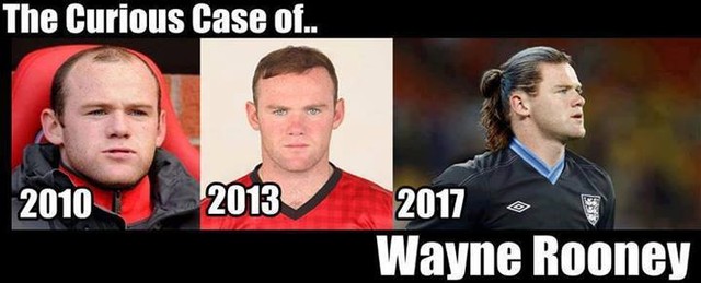 	Tóc của Rooney ngày càng rậm