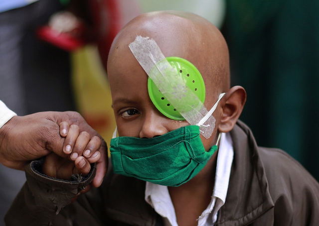 Một em bé mắc bệnh ung thư rời khỏi bệnh viện trong ngày Ung thư thế giới ở Mumbai, Ấn Độ.