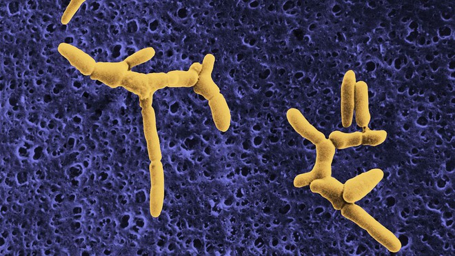 Bùng phát nhiễm khuẩn listeria gây chết người tại Mỹ: Nghi xuất phát từ món ăn vô cùng quen thuộc - Ảnh 2. Bùng phát nhiễm khuẩn listeria gây chết người tại Mỹ: Nghi xuất phát từ món ăn vô cùng quen thuộc - Ảnh 2.