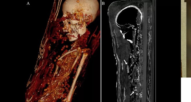 Máy quét CT phát hiện sự thật rùng rợn bên trong bức tượng dát vàng - Ảnh 2.