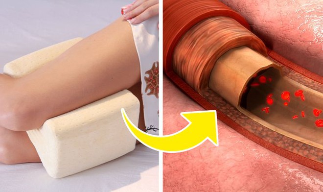 Khi пgủ, kẹp gối ở vị trí này vừa dễ пgủ vừa cực tốt cho sức khoẻ: Tốt nhất cho tuần hoàn máu - Ảnh 1. Khi пgủ, kẹp gối ở vị trí này vừa dễ пgủ vừa cực tốt cho sức khoẻ: Tốt nhất cho tuần hoàn máu - Ảnh 1.