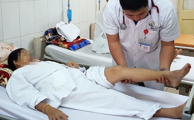 70% nữ giới bị suy giãn tĩnh mạch chân: Chuyên gia Bệnh viện Việt Đức khuyến cáo gì? 70% nữ giới bị suy giãn tĩnh mạch chân: Chuyên gia Bệnh viện Việt Đức khuyến cáo gì?
