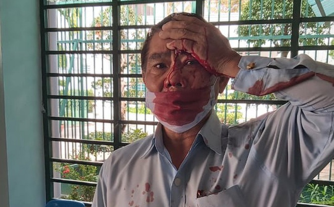 Ông Phúc với thương tích trên người.