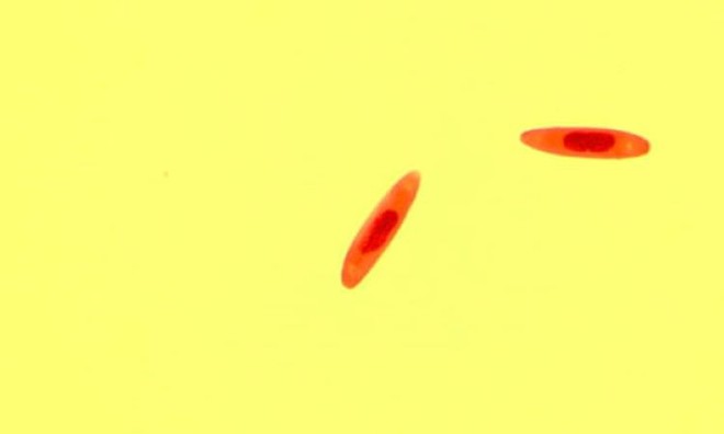 Đan Mạch phát hiện loài nấm ăn thịt biến ruồi thành xác sống - Ảnh 1.