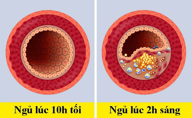 Khi đi ngủ trước - sau 10h tối, cơ thể con người sẽ khác nhau như thế nào? - Ảnh 4.