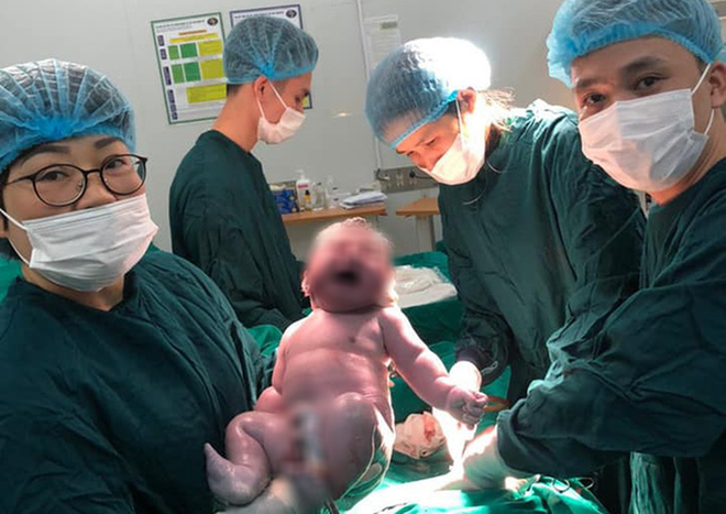 Sản phụ 40 tuổi sinh bé trai sơ sinh nặng gần 6 kg - Ảnh 1.