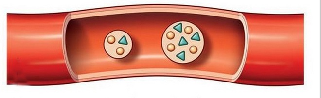 Nguy hiểm khi chỉ số triglyceride tăng - Ảnh 2.