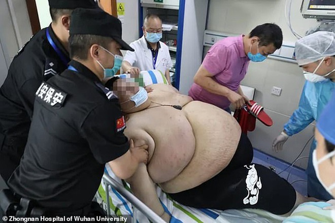 Thanh niên Trung Quốc cấp cứu do tăng 100 kg trong 5 tháng trốn dịch - Ảnh 3.