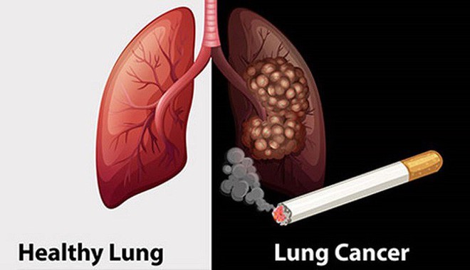 Thói quen có thể gây hại cho các cơ quan đặc biệt của cơ thể - Ảnh 7.