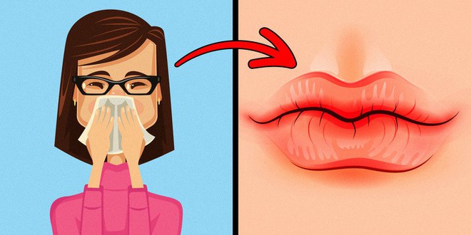 8 dấu hiệu của đôi môi tiết lộ tình trạng sức khoẻ của bạn - Ảnh 2.