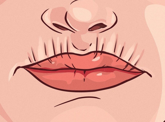 8 dấu hiệu của đôi môi tiết lộ tình trạng sức khoẻ của bạn - Ảnh 5.