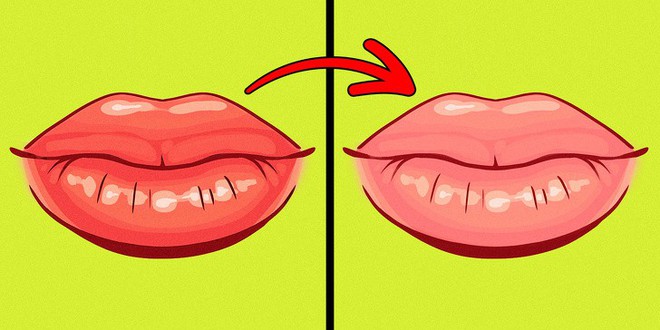 8 dấu hiệu của đôi môi tiết lộ tình trạng sức khoẻ của bạn - Ảnh 6.